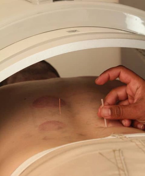 כאבי גב טיפול_533x800