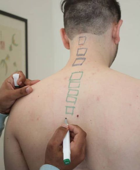 סימון חוליות עליון_533x800